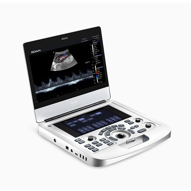 เครื่องตรวจอวัยวะภายในด้วยคลื่นเสียงความถี่สูงชนิดพกพา Ultrasound diagnotic system  Acclarix AX3  EDAN