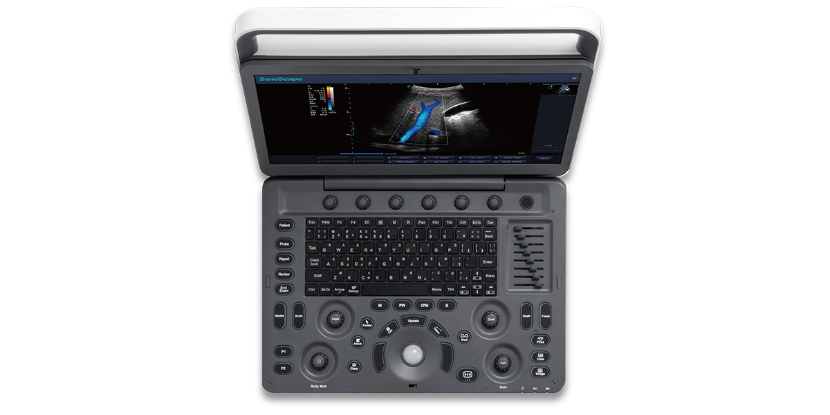 เครื่องตรวจอวัยวะภายในด้วยคลื่นเสียงความถี่สูงแบบหิ้วถือ ชนิด 2 หัวตรวจ E2 SonoScape