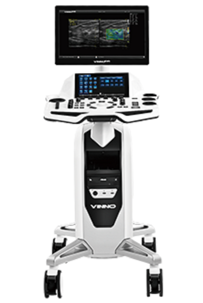 เครื่องตรวจอวัยวะภายในด้วยคลื่นเสียงความถี่สูง Ultrasound diagnotic system  E35  VINNO