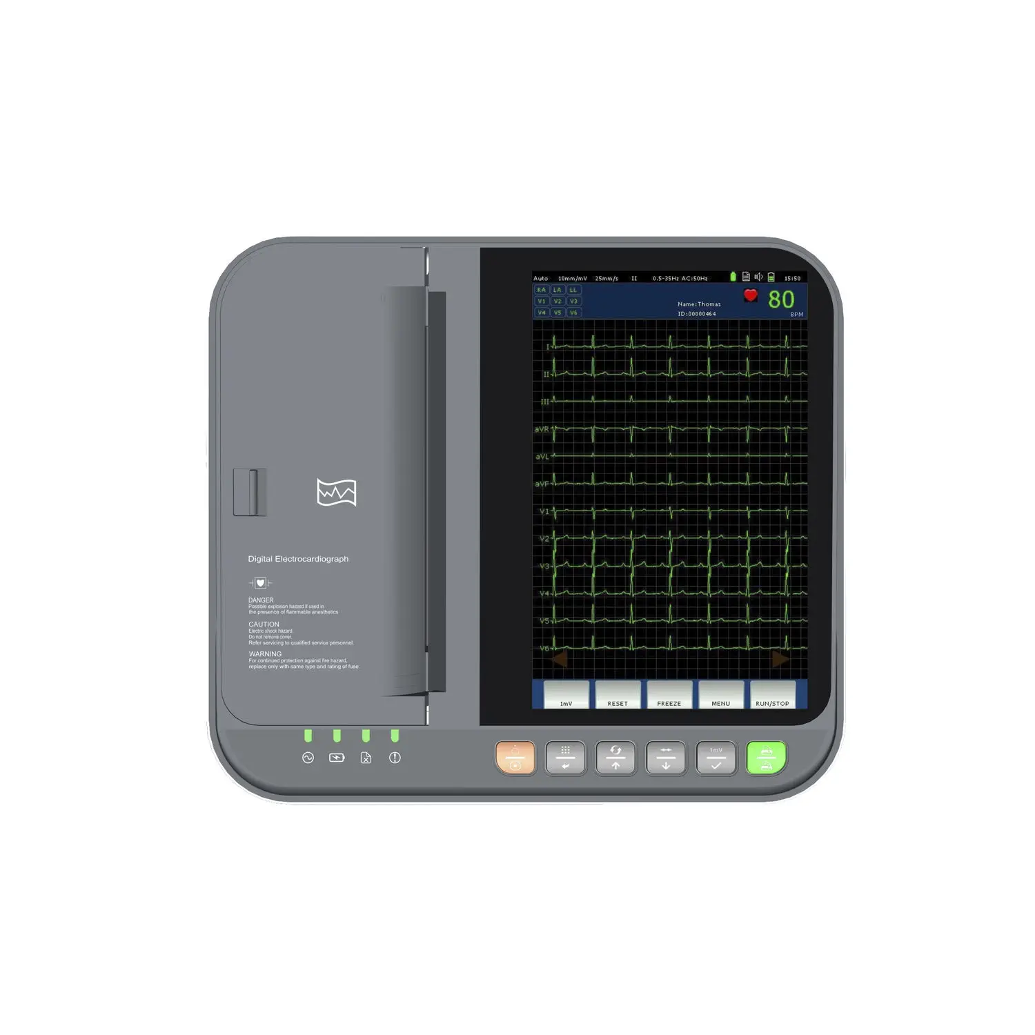 เครื่องตรวจคลื่นไฟฟ้าหัวใจ พร้อมระบบวิเคราะห์ผลสำหรับสัตว์  12-channel veterinary ECG system DE12-VET  Dawei