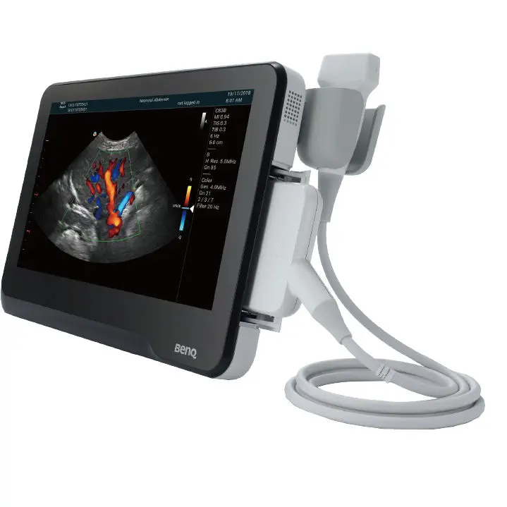 เครื่องอัลตราซาวด์แบบพกพาชนิดสีสำหรับสัตว์ Portable veterinary ultrasound system T3300v  BenQ