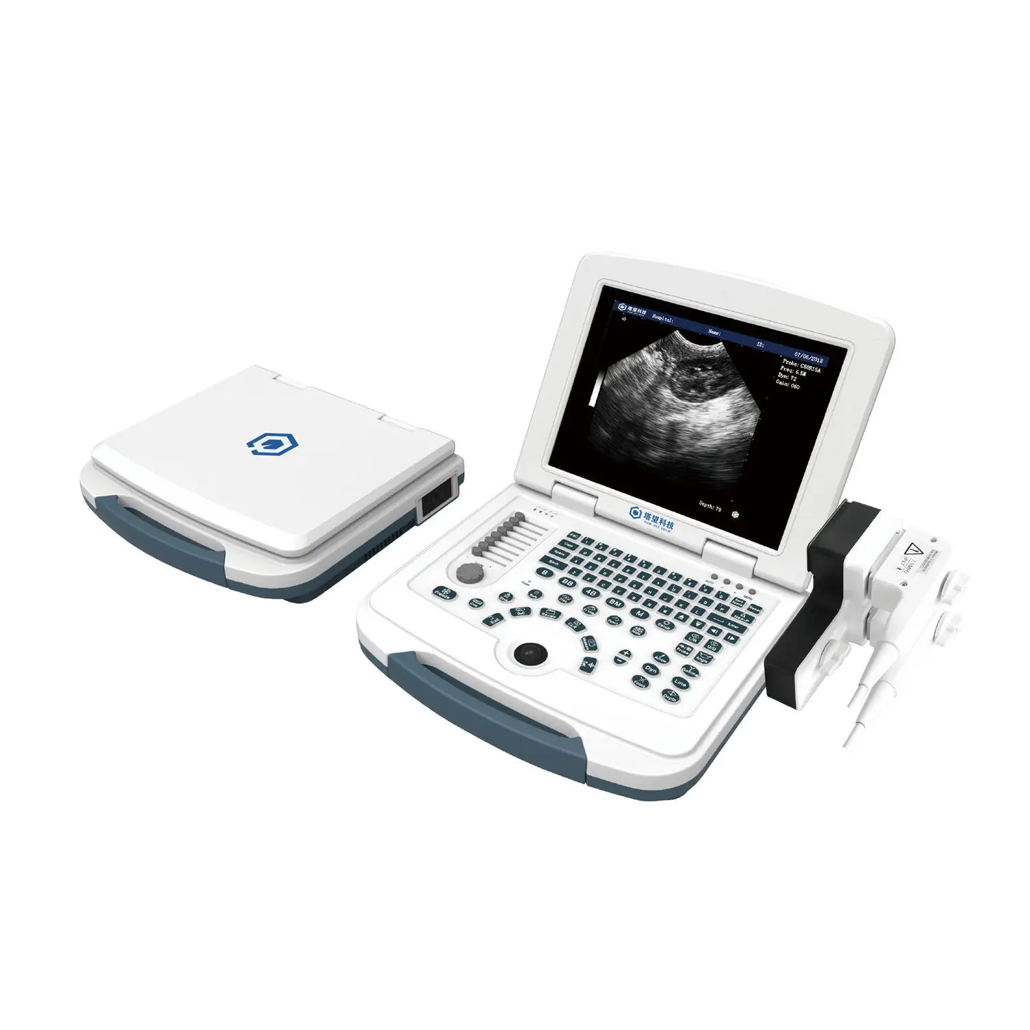 เครื่องอัลตราซาวด์แบบพกพาสำหรับสัตว์  Portable veterinary ultrasound system VSM 10  TOW Intelligent
