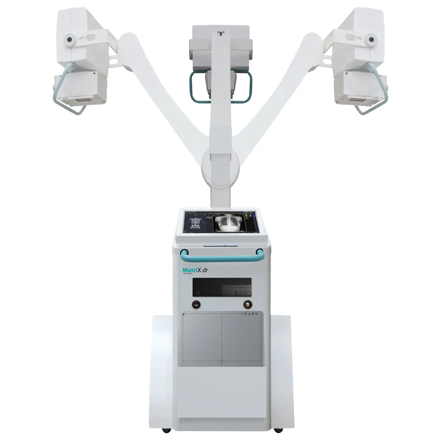 รถเอกซเรย์เคลื่อนที่ด้วยระบบดิจิตอล  Digital mobile radiography unit MatriX DR  IBIS s.r.l. X Ray Systems