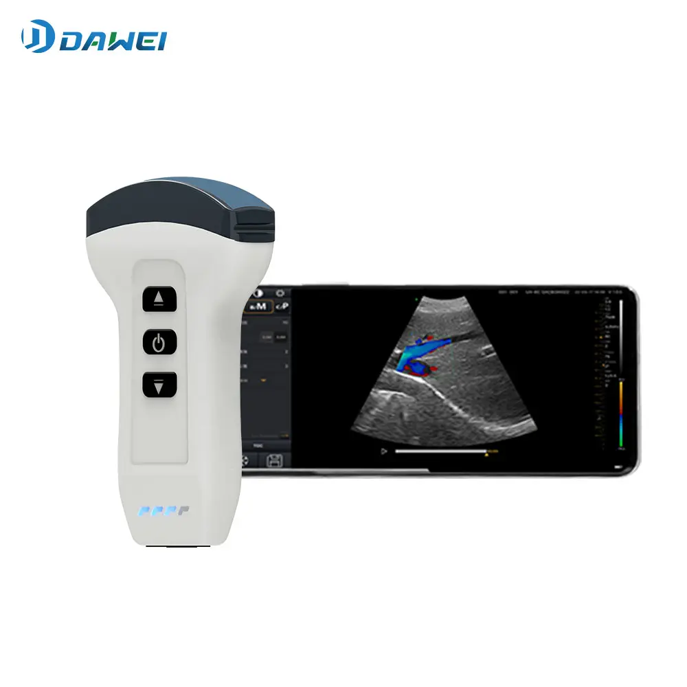 เครื่องตรวจอัลตร้าซาวด์แบบพกพามือถือ Wireless  Double Probes Handheld Ultrasound Scanners（Convex+Linear) DW-X1  DAWEI