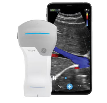 เครื่องอัลตราซาวด์แบบมือถือ  Hand-held ultrasound system Vscan Air™  GE Healthcare