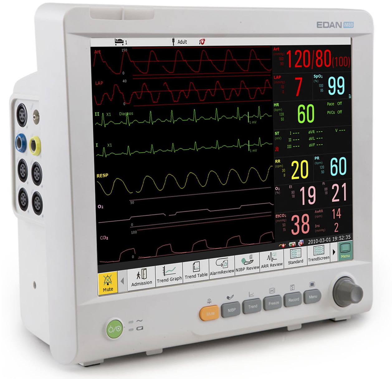 เครื่องติดตามการทำงานของหัวใจและสัญญาณชีพ/Patient Monitor equipment